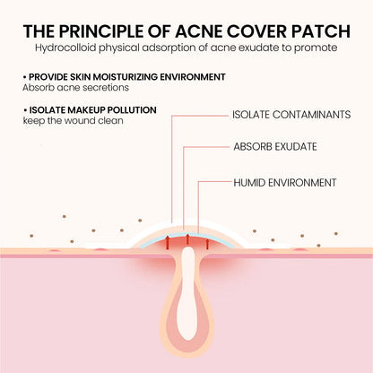 200Pcs Repair Acne Patch Fade Blemishes Pimple Marks Closed Acne Blemishes Hydrocolloid Star Shaped Cover Acne Pimple Patch
