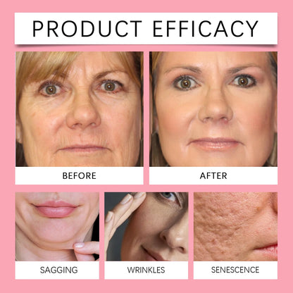 قناع تقشير الكولاجين، قناع تغليف الكولاجين الليلي، قناع ترطيب الكولاجين المتحلل، العناية بالبشرة الكورية