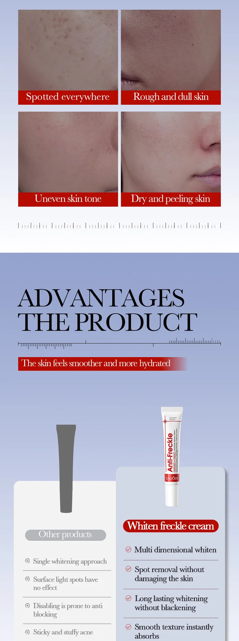 SADOER Anti Freckle Cream Face Whitening Creams Spot Removing Anti-aging Moisturizing Freckles Removal Facial Cream Skin Care